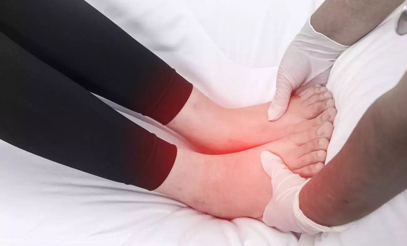 antalya Lenfödem tedavisi