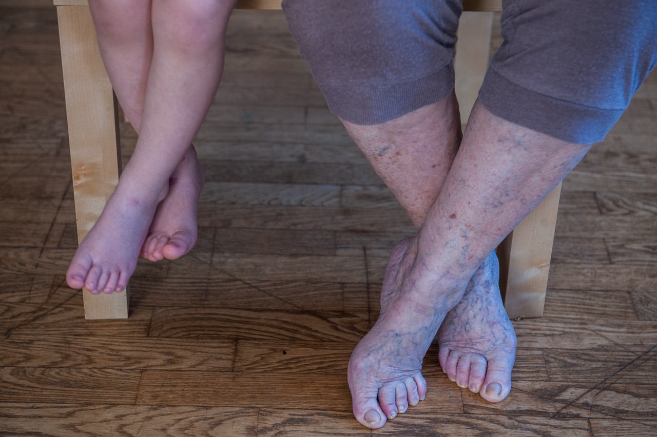 lenfödem masaji nasil yapilir