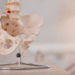 Sakroiliak Eklem Kireçlenmesi Belirtileri ve Tedavi Yöntemleri