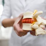 bel fıtığı düzelir mi