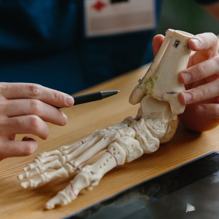 ayak kireçlenmesinin tedavisi