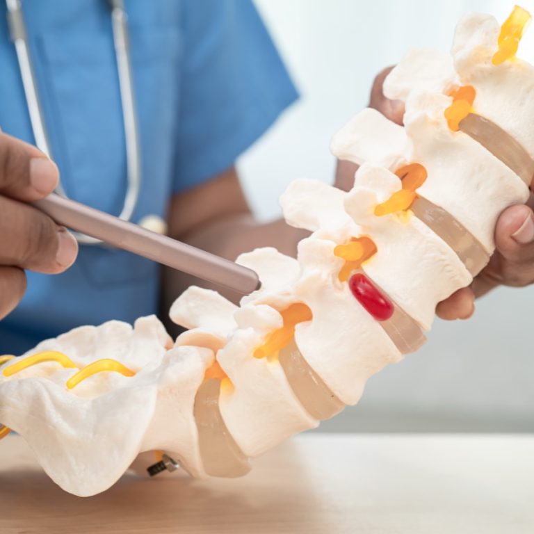 bel fıtığı masajı nasıl yapılır