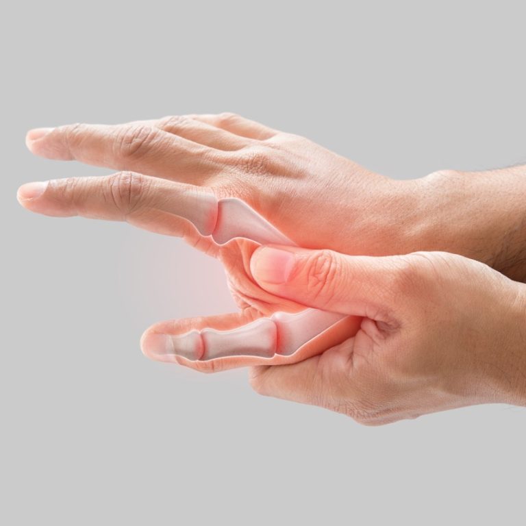 parmakta kireçlenme