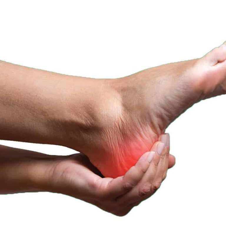 topuk dikenine ne iyi gelir